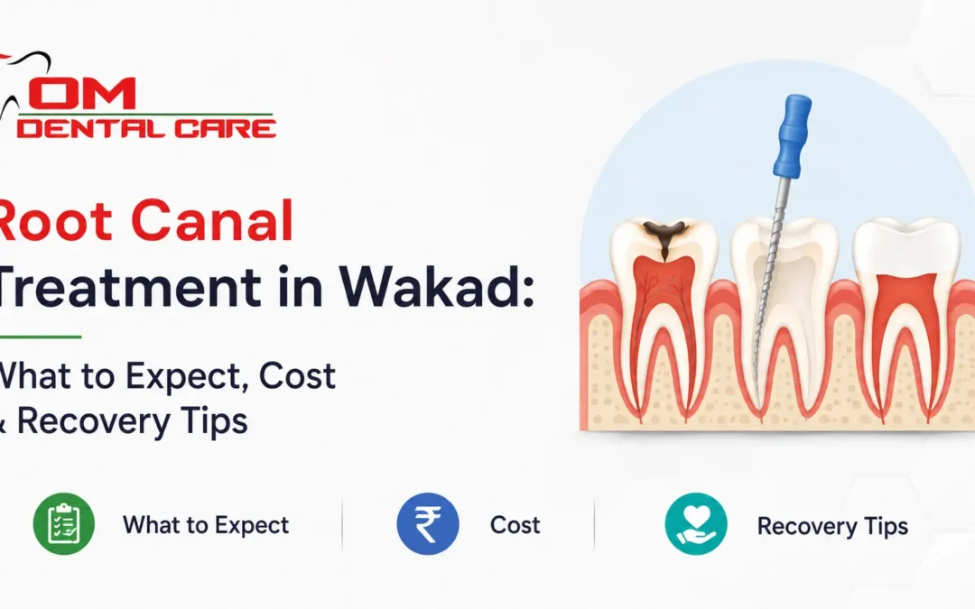 Root Canal Treatment in Wakad: Cost & Recovery