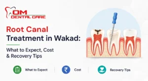 Root Canal Treatment in Wakad: Cost & Recovery