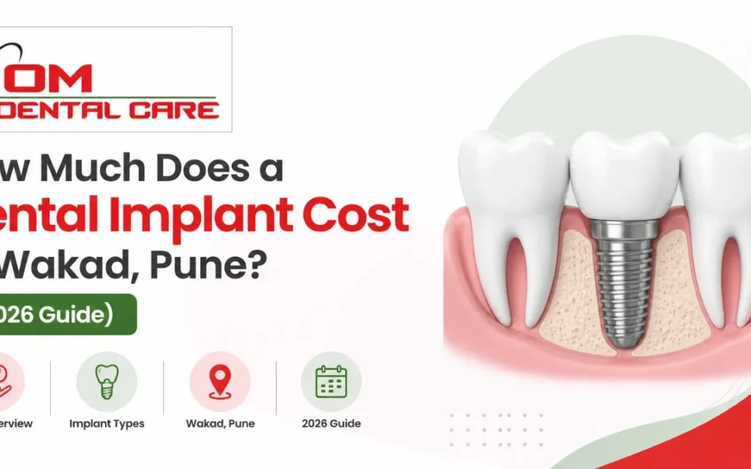 How Much Does a Dental Implant Cost in Wakad, Pune? (2026 Guide)