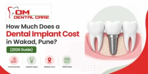 How Much Does a Dental Implant Cost in Wakad, Pune?