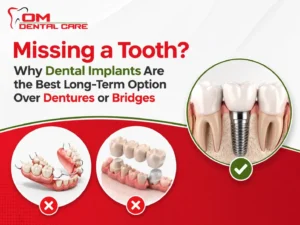 Missing a Tooth? Why Dental Implants Are the Best Long-Term Option Over Dentures or Bridges